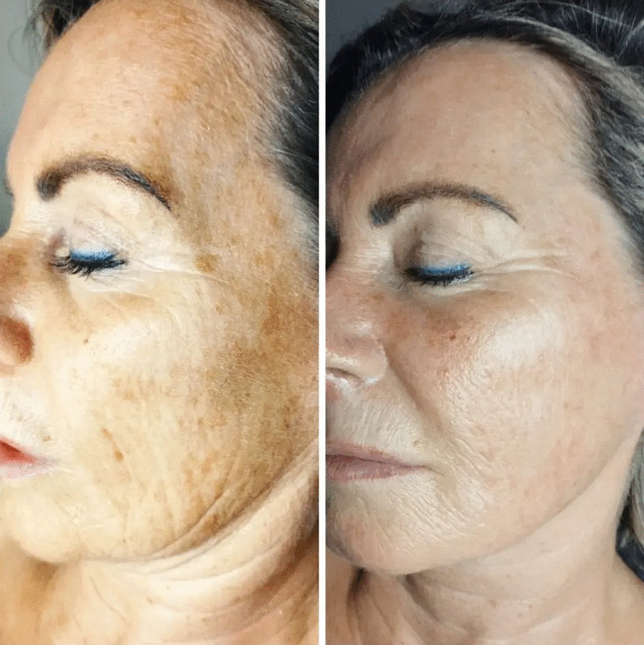 Foto in het carousel.