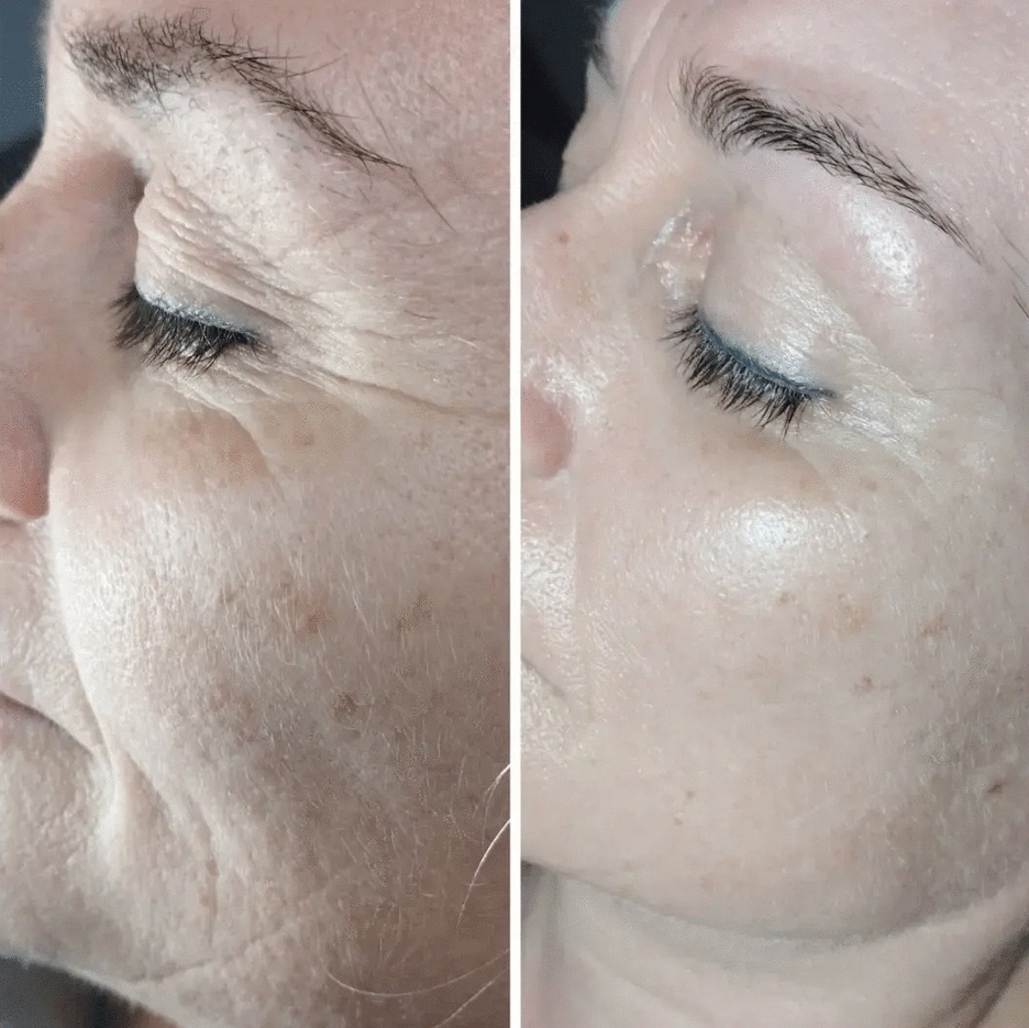 Foto in het carousel.